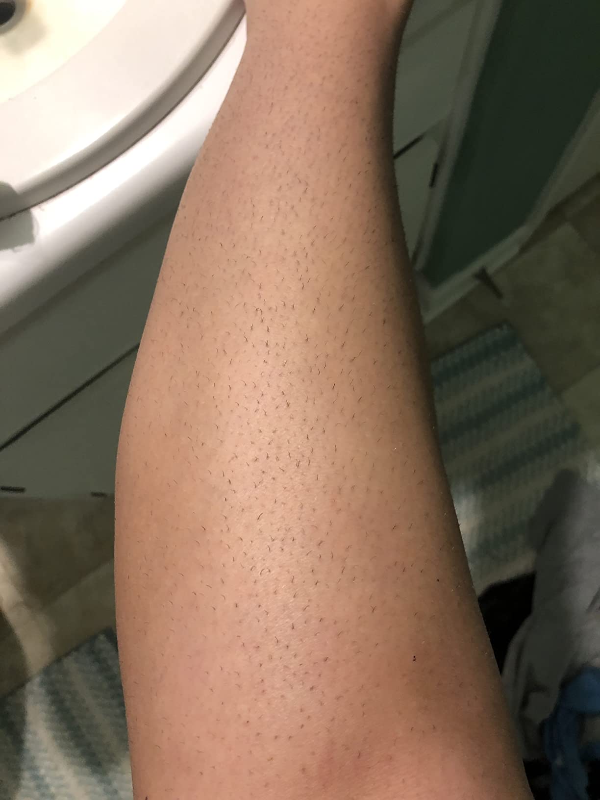 best hair removal device
