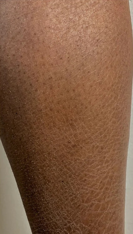 skin exfoliators for body